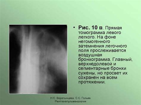 Причины тотального затемнения