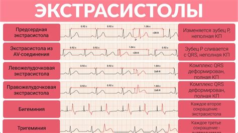 Причины увеличения числа экстрасистол