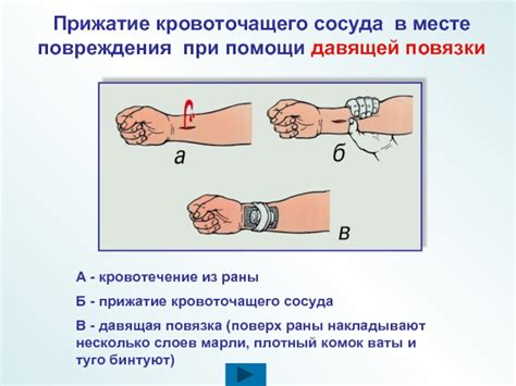 При зажатии сосуда в шее: первая помощь