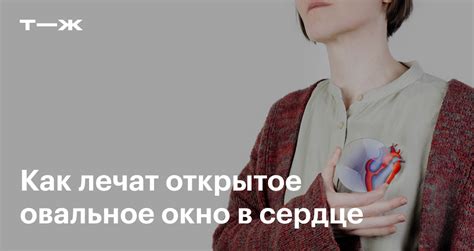 Проблемы, связанные с открытым овальным окном