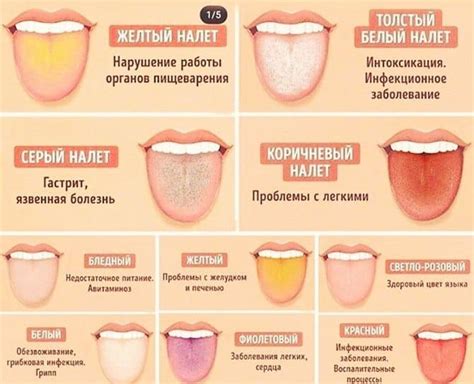 Проблемы со здоровьем, приводящие к появлению черного налета на языке