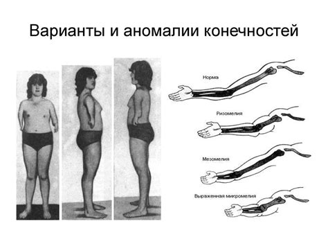 Пропорциональность конечностей