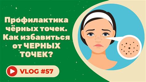 Профилактика: как предотвратить возникновение чёрных точек?