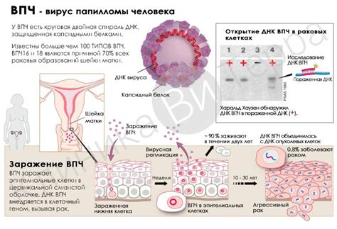 Профилактика ВПЧ 44 типа у женщин