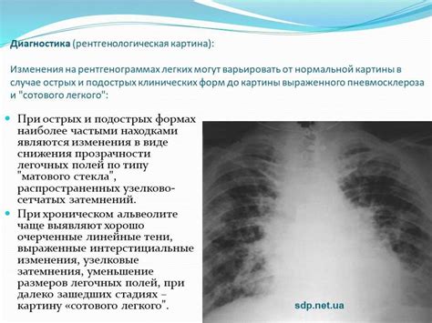 Профилактика и лечение диффузного пневмосклероза