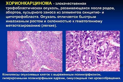 Профилактика и лечение опухоли