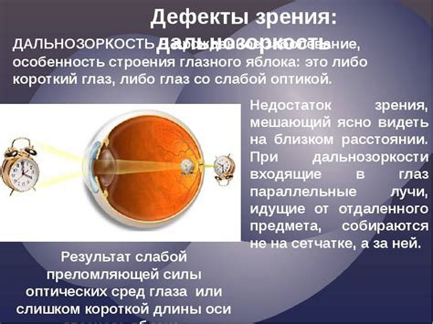 Профилактика нарушения бинокулярного зрения