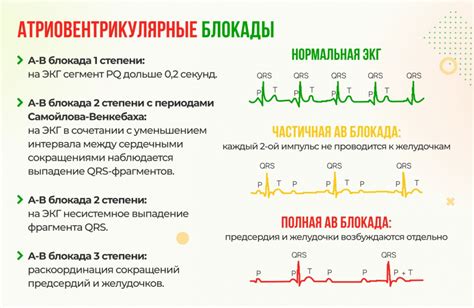 Профилактика неполной блокады на ЭКГ