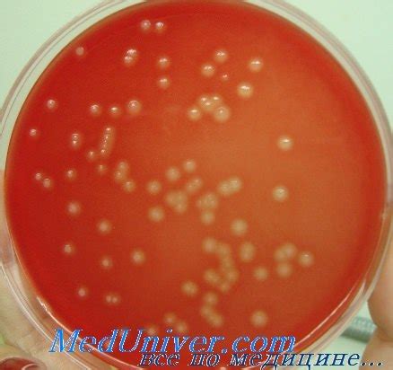 Профилактика Streptococcus agalactiae