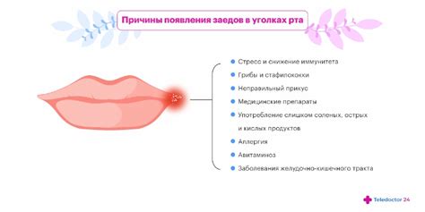 Психологические и эмоциональные факторы, влияющие на кожу в уголках рта