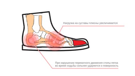 Пятка на обуви постоянно изнашивается из-за неправильной посадки