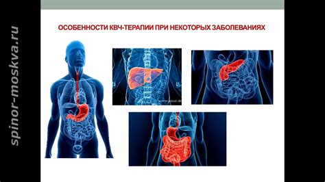 Развитие разрыва пищевода при заболеваниях пищеварительной системы