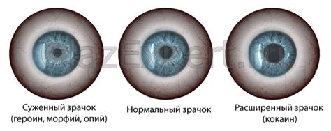 Различия в размере зрачков