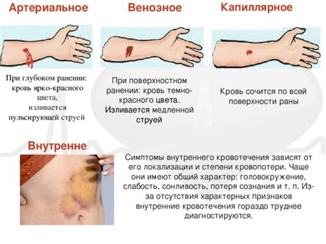 Разрывы швов и внутренние кровотечения