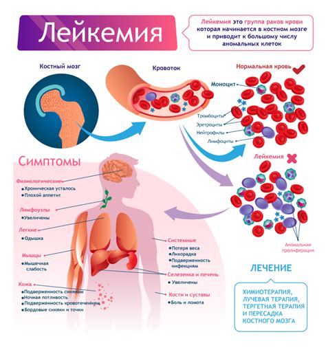 Рак крови: симптомы, причины и лечение