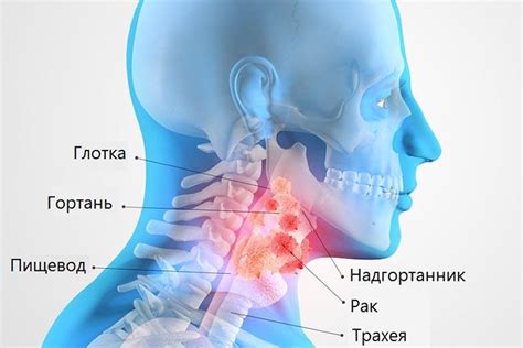 Распространенные симптомы и признаки