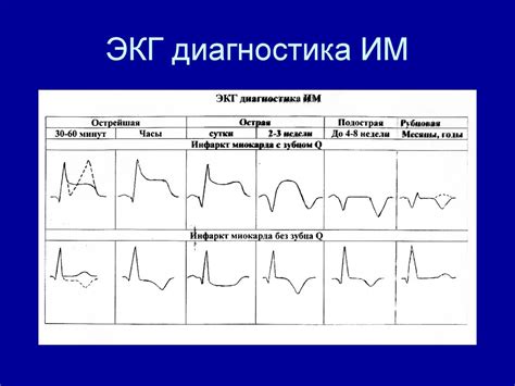 Расшифровка и интерпретация ЭКГ при симптомах ССРЖ