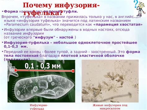 Рацион питания инфузории туфелька: от автотрофии до гетеротрофии