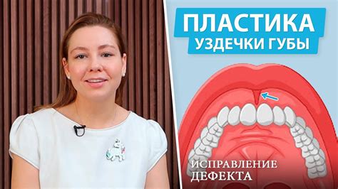 Реабилитация после лечения порванной уздечки