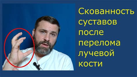 Резкое снижение активности суставов после лучевой терапии