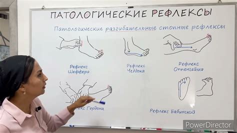 Рефлексы при расслабленном тонусе мышц