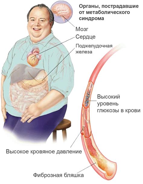 Риск метаболического синдрома при высоком уровне калия