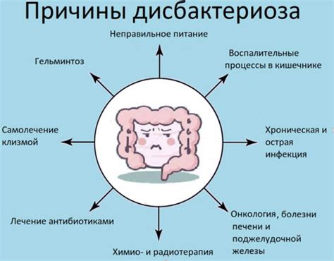 Риск развития дисбактериоза