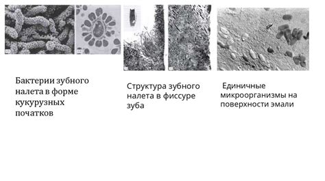 Риск развития кариеса и зубного налета