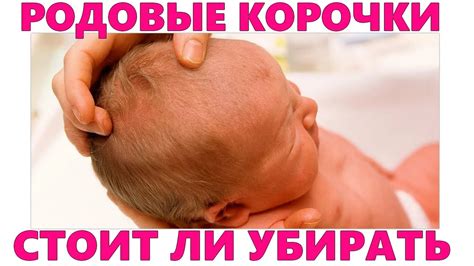 Родовая грязь на голове ребенка: что это такое?