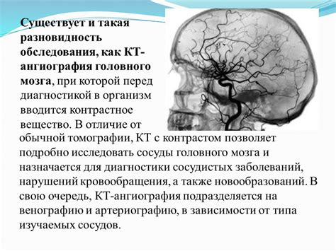 Роль КТ в диагностике головного мозга