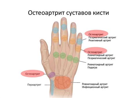 Роль нервной системы в ощущении онемения левой руки и пальцев