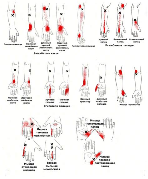 Роль триггерных точек в анатомии человека