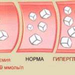 Сахарный диабет и гипогликемия