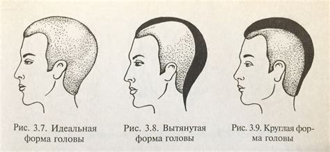 Своеобразная форма головы