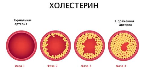 Связь между липопротеинами высокой плотности и холестерином