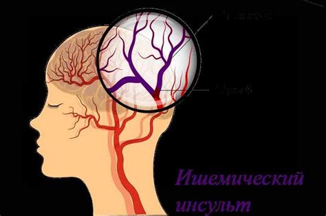 Связь положения ног и проблем с кровообращением