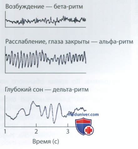 Связь с нарушениями сна и бодрствования