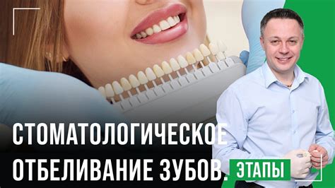 Секреты отбеливания