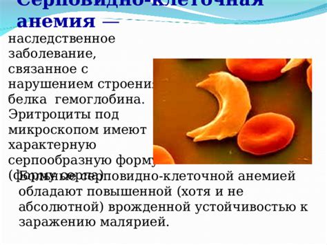 Семейная анемия: наследственное заболевание