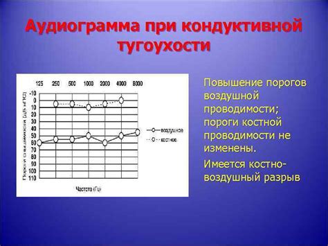 Сенсоневральная потеря слуха