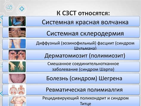 Симптомы аутоиммунных заболеваний соединительной ткани