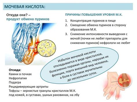 Симптомы высокого уровня мочевой кислоты в крови 431