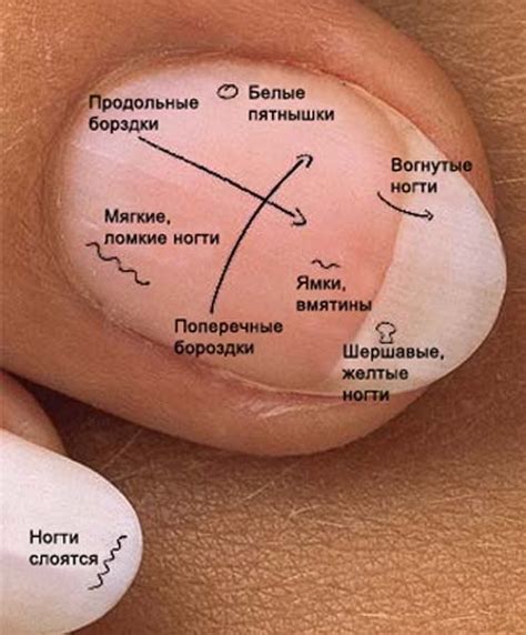 Симптомы и диагностика проблем с ногами