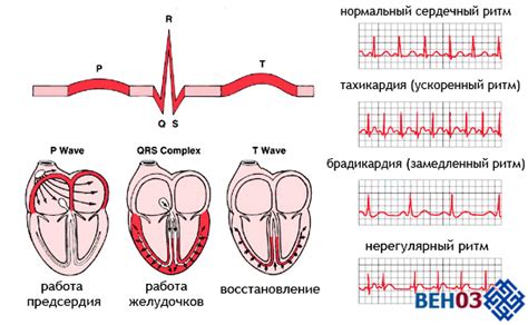 Симптомы и диагностика синусовой дыхательной аритмии