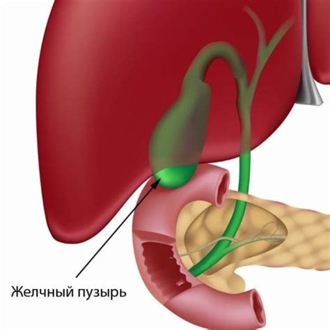 Симптомы и лечение изгиба желчного пузыря