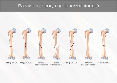 Симптомы и признаки внутренних повреждений