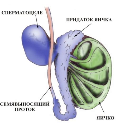 Симптомы и признаки жировика на мошонке