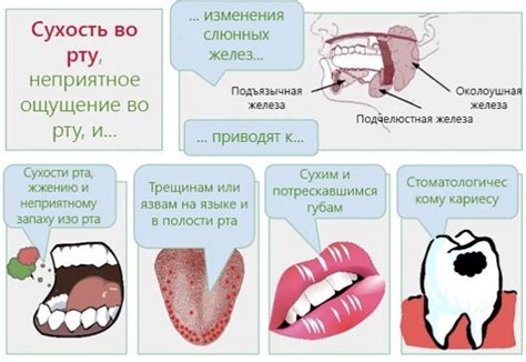 Симптомы и причины возникновения язвочек во рту ребенка