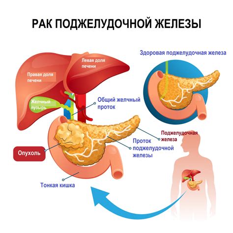 Симптомы и причины застуды грудной железы