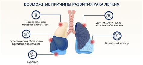 Симптомы и проявления кальцината в легких